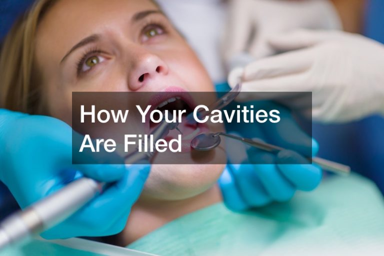 How Your Cavities Are Filled