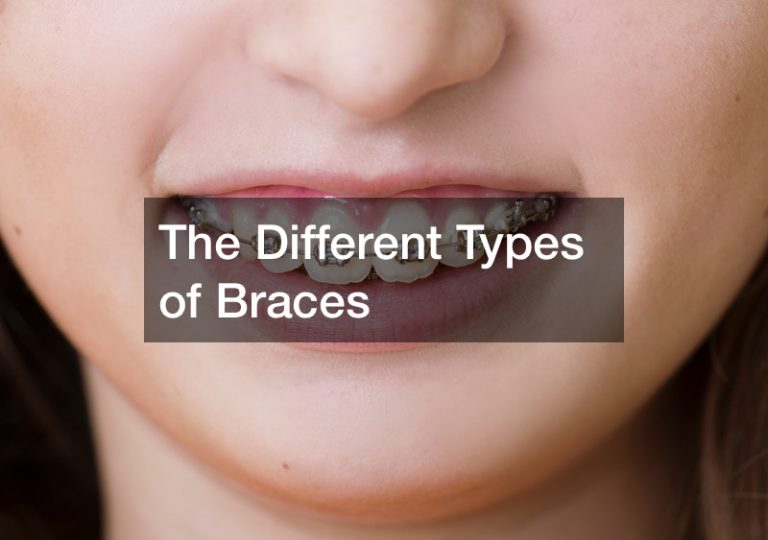 The Different Types of Braces