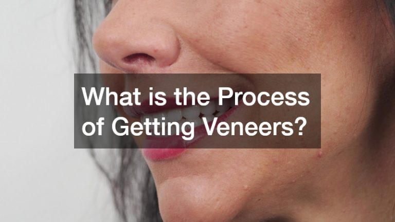 What is the Process of Getting Veneers?