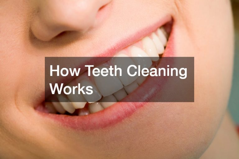 How Teeth Cleaning Works