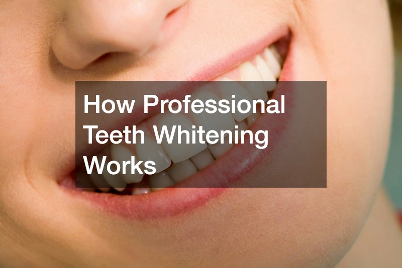How Professional Teeth Whitening Works
